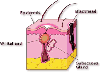 Read this to see how Oxygen is the ultimate Acne Control