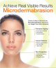 MicroDermabrasion with Short Hungarian Facial